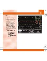 Preview for 74 page of GE DASH 3000 V5 Quick Reference Manual