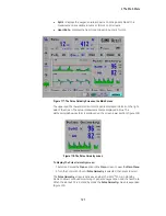 Предварительный просмотр 133 страницы GE iVent 201 1.4 User'S Reference Manual