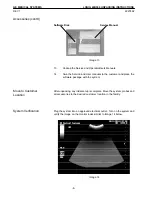 Предварительный просмотр 12 страницы GE LOGIQ 400 Unpacking Instructions Manual