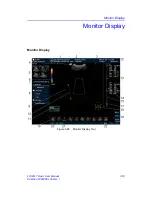 Предварительный просмотр 111 страницы GE LOGIQ 7 Basic User Manual