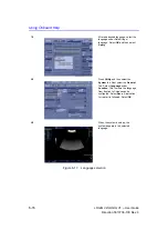 Предварительный просмотр 348 страницы GE LOGIQ V1 User Manual