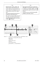 Preview for 34 page of GE Marquette Responder 3000 Operator'S Manual