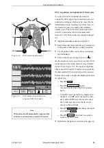 Preview for 35 page of GE Marquette Responder 3000 Operator'S Manual