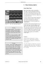 Preview for 49 page of GE Marquette Responder 3000 Operator'S Manual