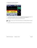 Preview for 65 page of GE Responder 2000 Operator'S Manual