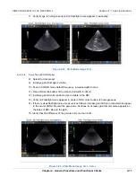 Предварительный просмотр 136 страницы GE Venue Fit Technical Publication