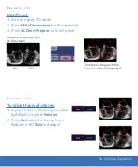 Предварительный просмотр 22 страницы GE Vivid E9 Quick Reference Cards