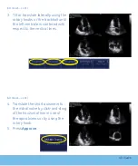 Предварительный просмотр 29 страницы GE Vivid E9 Quick Reference Cards