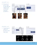 Предварительный просмотр 32 страницы GE Vivid E9 Quick Reference Cards