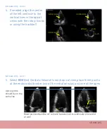 Предварительный просмотр 35 страницы GE Vivid E9 Quick Reference Cards