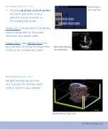 Предварительный просмотр 50 страницы GE Vivid E9 Quick Reference Cards