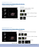 Предварительный просмотр 57 страницы GE Vivid E9 Quick Reference Cards