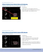 Предварительный просмотр 58 страницы GE Vivid E9 Quick Reference Cards