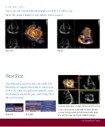 Предварительный просмотр 74 страницы GE Vivid E9 Quick Reference Cards