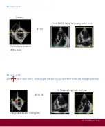 Предварительный просмотр 77 страницы GE Vivid E9 Quick Reference Cards