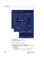 Preview for 216 page of GE Vivid i User Manual