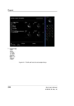 Preview for 248 page of GE Vivid i User Manual