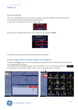 Предварительный просмотр 6 страницы GE Vivid P3 How-To