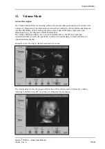 Предварительный просмотр 187 страницы GE Voluson 730Pro Basic User Manual