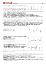 Preview for 14 page of Gima Cardio-A Palm ECG Use And Maintenance Book