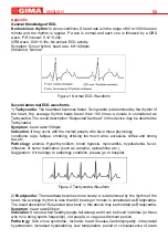 Предварительный просмотр 52 страницы Gima CARDIO-B Use And Maintenance Book