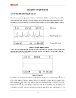 Preview for 23 page of Gima VITAL-SNET User Manual