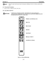 Preview for 13 page of Global Surgical SMR S 4000 Owner'S Manual