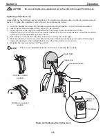 Предварительный просмотр 18 страницы Global Surgical SMR S 4000 Owner'S Manual