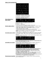 Preview for 9 page of Gorenje IT624ASC Instructions For Use, Installation, And Connection