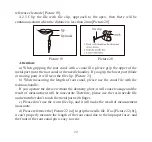 Preview for 22 page of Guilin Woodpecker Medical Instrument Ai-Pex Instruction Manual