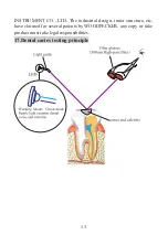 Preview for 15 page of Guilin Woodpecker Medical Instrument X-Cure Instruction Manual