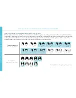 Preview for 5 page of HairMax LaserComb Ultima 9 User Manual