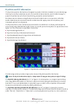 Предварительный просмотр 26 страницы HeartSciences MyoVista  wavECG User Manual