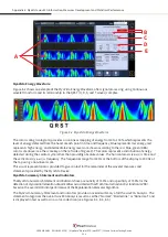 Предварительный просмотр 127 страницы HeartSciences MyoVista  wavECG User Manual