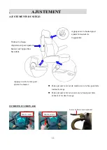 Предварительный просмотр 11 страницы Heartway Medical Products S12X Manual