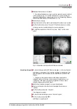 Preview for 29 page of Heidelberg Engineering SPECTRALIS User Manual