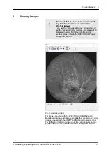 Preview for 31 page of Heidelberg Engineering SPECTRALIS User Manual