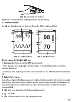 Preview for 111 page of Henry Schein 900-8275 Instructions For Use Manual