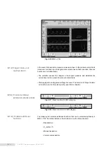 Предварительный просмотр 112 страницы Heyer iTernIS ADV Operator'S Manual