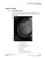 Предварительный просмотр 85 страницы Hologic 3Dimensions User Manual