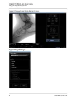 Предварительный просмотр 74 страницы Hologic Fluoroscan InSight FD Mini C-arm User Manual