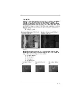 Preview for 179 page of Honeywell Vuquest 3310g User Manual