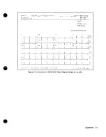 Предварительный просмотр 70 страницы HP M1754A Service Manual