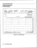 Preview for 27 page of HP Pagewriter XLi M1700A Operating Manual