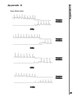 Preview for 63 page of Huntleigh D900-P Service Manual