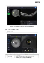 Preview for 25 page of Huvitz HOCT-1 User Manual