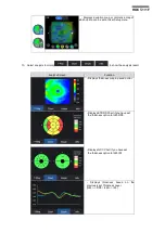 Preview for 69 page of Huvitz HOCT-1 User Manual