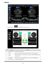 Preview for 88 page of Huvitz HOCT-1 User Manual