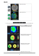 Preview for 94 page of Huvitz HOCT-1 User Manual