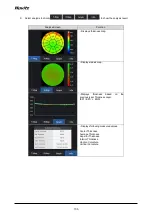 Preview for 106 page of Huvitz HOCT-1 User Manual